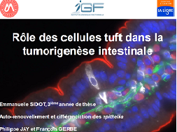 CO039 - Rôle des cellules tuft dans la tumorigenèse intestinale
