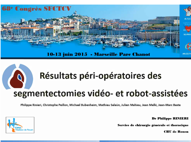 Résultats périopratoires des segmentectomies pulmonaires vidéo et robotassistés Résultats périopratoires des segmentectomies pulmonaires vidéo et robotassistés