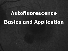 Rétine, Vitreux - Bases et applications de l'Autofluorescence Rétine, Vitreux - Bases et applications de l'Autofluorescence