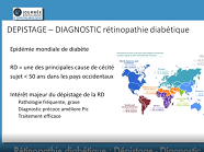 Rétinopathie diabétique