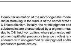 Radial Streaking in the Fundus of the Carrier State of X-Linked Albinism Radial Streaking in the Fundus of the Carrier State of X-Linked Albinism