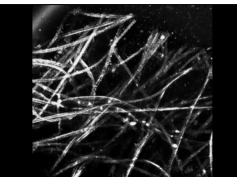 Radial Video Captured Using Reflectance Confocal Microscopy