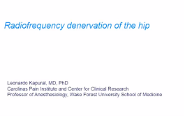 Radio Frequency Denervation of the Hip