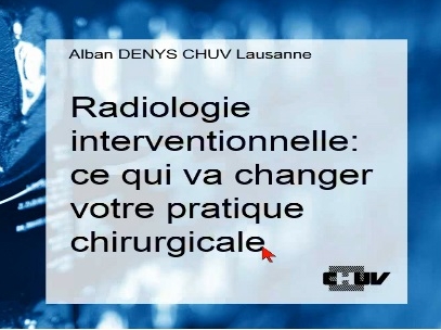 Radiologie interventionnelle : ce qui va changer votre pratique chirurgicale