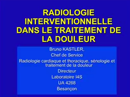 Radiologie interventionnelle dans le traitement de la douleur partie 2 Radiologie interventionnelle dans le traitement de la douleur partie 2