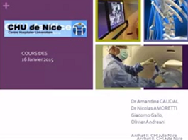 Radiologie interventionnelle dans le traitement de la douleur partie 3 Radiologie interventionnelle dans le traitement de la douleur partie 3