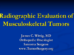 Radiology of Musculoskeletal Tumors