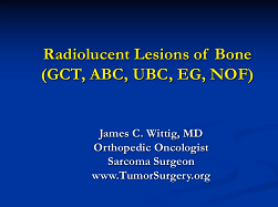 Radiolucent Lesions of Bone (GCT, ABC, UBC)