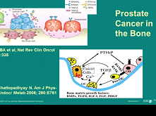 Radium 223: How Can We Optimize This New Tool for Metastatic Castration-Resistant Prostate Cancer ? Radium 223: How Can We Optimize This New Tool for Metastatic Castration-Resistant Prostate Cancer ?