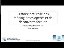 RAPPORT MENINGIOME (2/9) - Histoire naturelle des méningiome opérés et de découverte fortuite RAPPORT MENINGIOME (2/9) - Histoire naturelle des méningiome opérés et de découverte fortuite