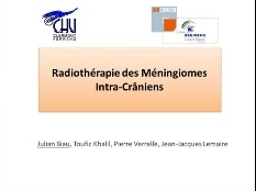 RAPPORT MENINGIOME (5/9) - Irradiation fractionnée et radiochirurgie