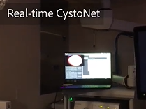 Real-time Augmented Bladder Tumor Detection with Deep Learning
