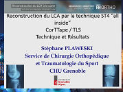 Reconstruction du LCA par la technique ST4 "all inside". CorTTape/TLS. Techniques et résultats Reconstruction du LCA par la technique ST4 "all inside". CorTTape/TLS. Techniques et résultats