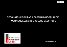 Reconstruction par colopharyngoplastie pour séquelles de brûlure caustique Reconstruction par colopharyngoplastie pour séquelles de brûlure caustique