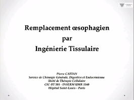 Reconstruction œsophagienne par ingénierie tissulaire Reconstruction œsophagienne par ingénierie tissulaire