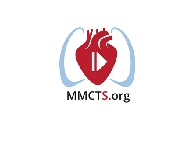 Redo mitral valve replacement through a right mini-thoracotomy with an unclamped aorta Redo mitral valve replacement through a right mini-thoracotomy with an unclamped aorta