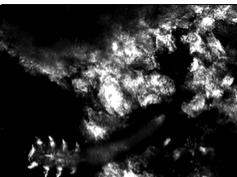 Reflectance Confocal Microscopy of Demodex folliculorum