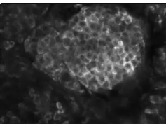 Reflectance Confocal Microscopy