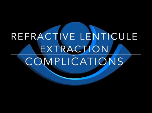 Refractive Surgery - Refractive Lenticule Extraction Complications