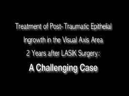 Chirurgie réfractive - Traitement de l'invasion épithéliale post-traumatique dans la zone de l'axe visuel deux ans après une chirurgie au LASIK : un cas difficile Chirurgie réfractive - Traitement de l'invasion épithéliale post-traumatique dans la zone de l'axe visuel deux ans après une chirurgie au LASIK : un cas difficile