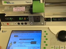 Relai automatique de noradrénaline