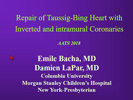 Repair of Taussig-Bing Heart with Inverted Coronaries
