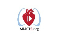 Repair of tricuspid papillary muscle rupture after percutaneous coronary intervention Repair of tricuspid papillary muscle rupture after percutaneous coronary intervention