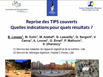 Reprise des TIPS couverts : quelles indications avec quels résultats ?