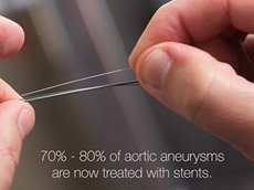 Researchers Develop New Stents for Complex Aortic Aneurysms - Mayo Clinic