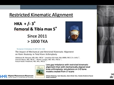 Restricted Kinematic Alignment TKA - with Personalized Instruments