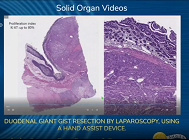 Results of the Fuse evaluation project in France