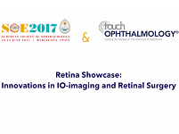 Retina Showcase: Innovations in IO-imaging and Retinal Surgery