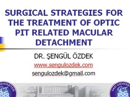 Rétine, Corps Vitreux - Différentes stratégies chirurgicales pour le traitement de la maculopathie de fosse de disque optique