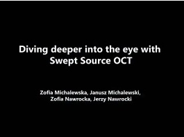 Rétine, Corps Vitreux - Plonger plus profondément dans l'œil avec une tomographie par cohérence optique à balayage