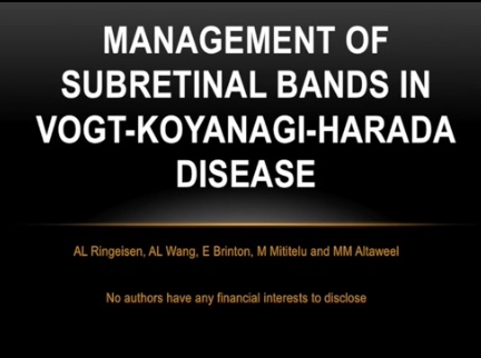 Retina, Vitreous - Management of Subretinal Bands in Vogt-Koyanagi-Harada Syndrome Retina, Vitreous - Management of Subretinal Bands in Vogt-Koyanagi-Harada Syndrome