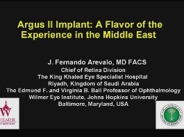 Rétine, Corps Vitreux - Hémorragie post-traumatique suprachoroïdienne après un traumatisme contondant dans une précédente kératoplastie : Surmonter un tabou