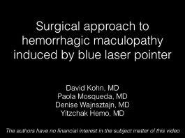 Rétine, Corps Vitreux - Approche chirurgicale de la maculopathie hémorragique induite par un laser-pointeur bleu