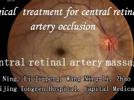 Rétine, Corps Vitreux - Traitement chirurgical de l'occlusion de l'artère centrale de la rétine - Massage direct de l'artère centrale de la rétine