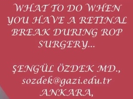 Rétine, Corps Vitreux - Qu'est-ce qui arrive quand vous avez une pause pendant la chirurgie d'une rétinopathie des prématurés (ROP)? Rétine, Corps Vitreux - Qu'est-ce qui arrive quand vous avez une pause pendant la chirurgie d'une rétinopathie des prématurés (ROP)?