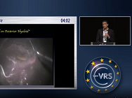 Retinal Push During Vitrectomy for Primary Retinal Detachment in Children