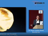 Retour d'experience sur la pose d'implant sous retinien alpha AMS