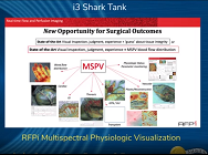 RFPi Multispectral Physiologic Visualization