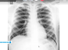 RG Academy ECG ECHO and Cases Bluejeans 24th July 2020