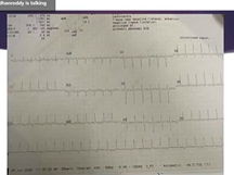 RG Academy ECG ECHO Discussions July 31 2020