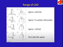 RG Academy Interactive Angiograms Part 3 11th July 2020