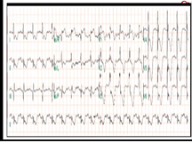 RG Academy Interactive Hemodynamics 3 27th June 2020