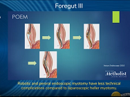 Robotic and peroral endoscopic myotomy have less technical complications