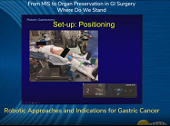 Robotic Approaches and Indications for Gastric Cancer