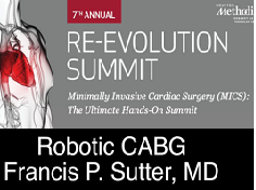 Robotic CABG