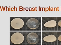 ROUND V. ANATOMIC Breast ImplantsDoes it Matter?